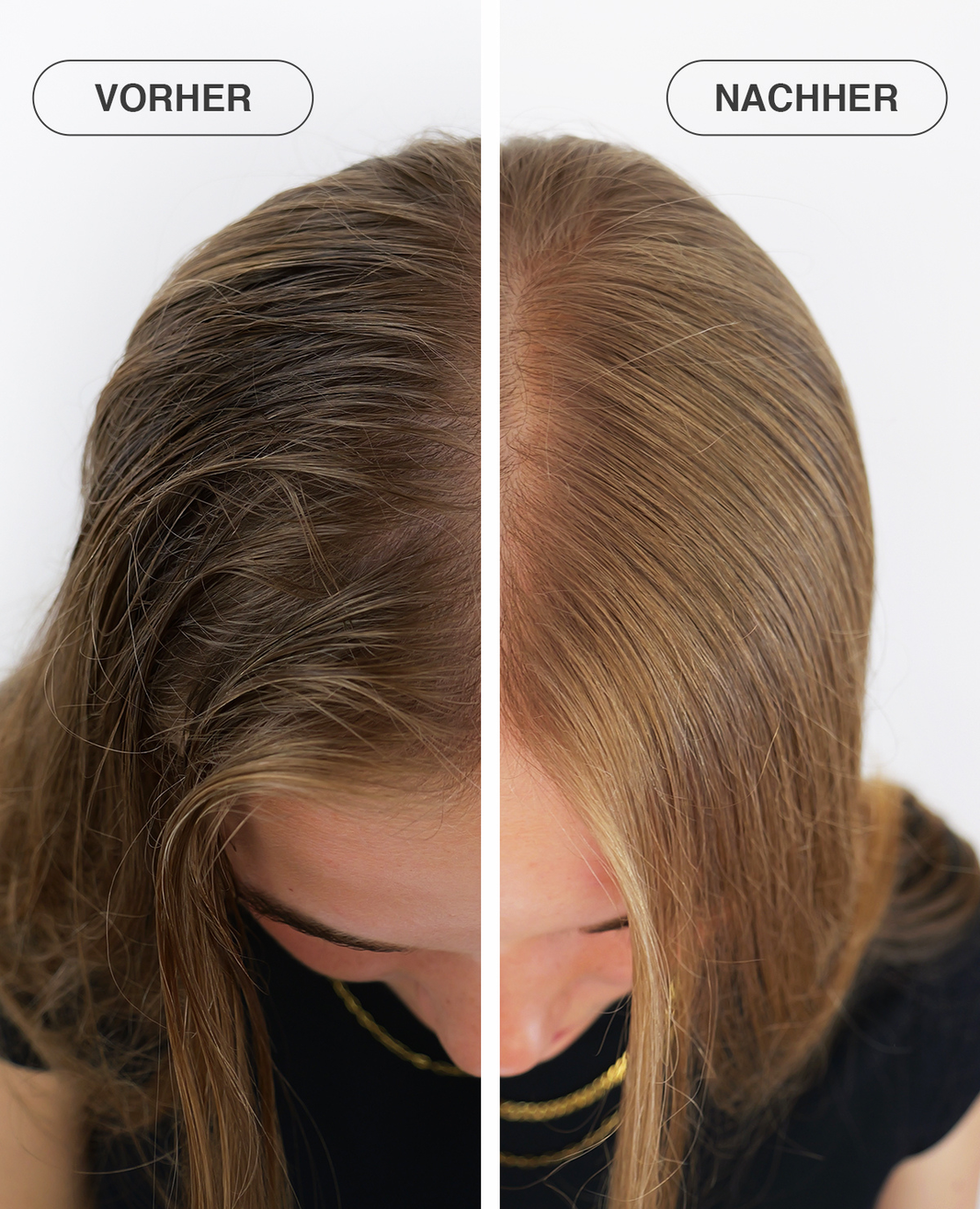 Hair Growth Set